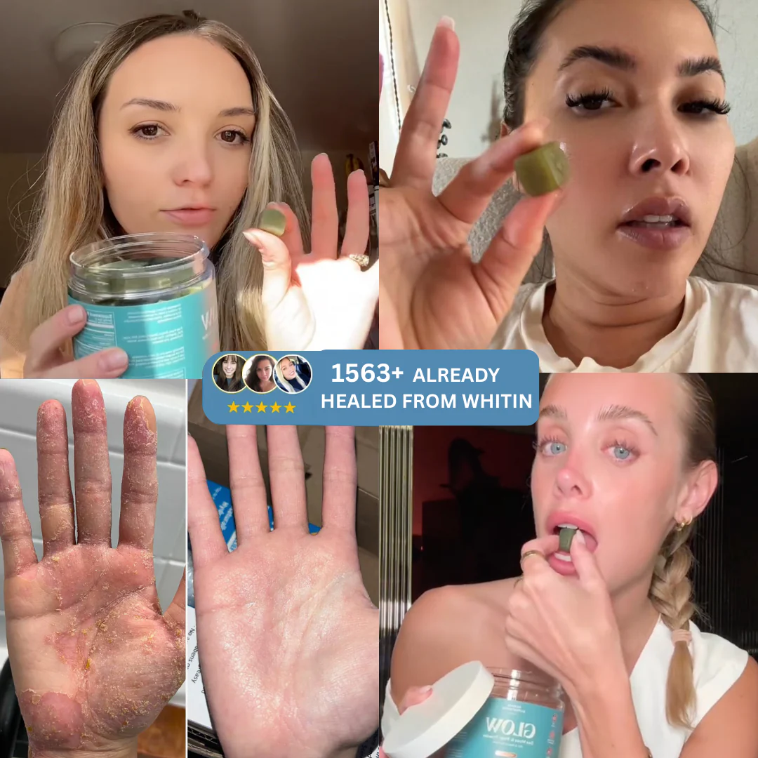 Eczema Relief Gummies