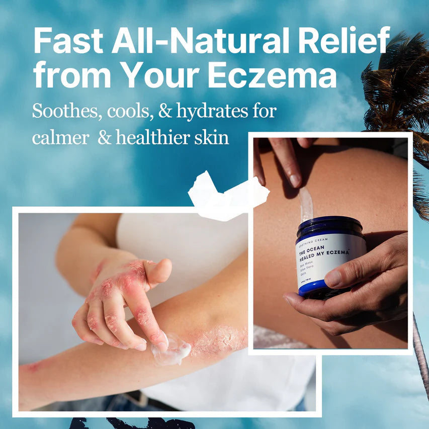 Eczema Relief Cream
